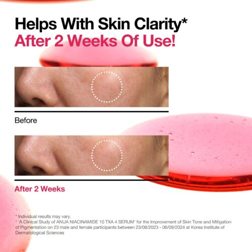Niacinamide 10 TXA 4 Serum