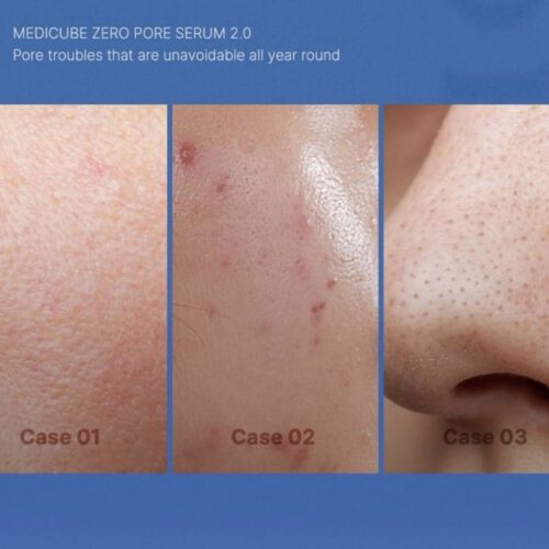 Zero Pore Serum 2.0