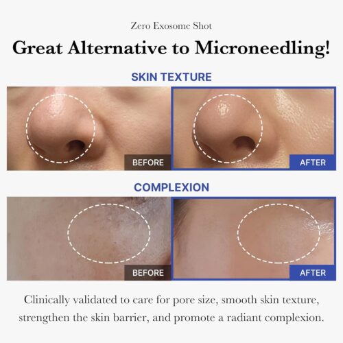 One Day Exosome Shot Pore Ampoule 7500