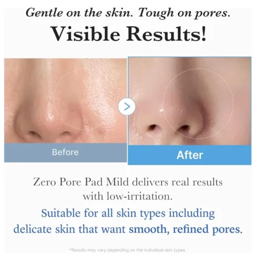 Zero Pore Pad Mild