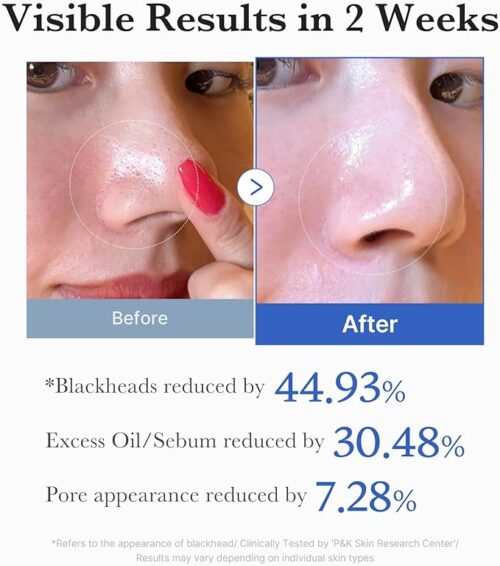 Zero Pore Pad