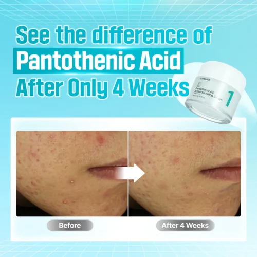 No.1 Pantothenic B5 Active Soothing Cream