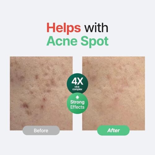 Wonder Releaf Centella Serum Unscented